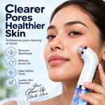 Hydro Pore Blackhead Remover – Rechargeable Pore Vacuum