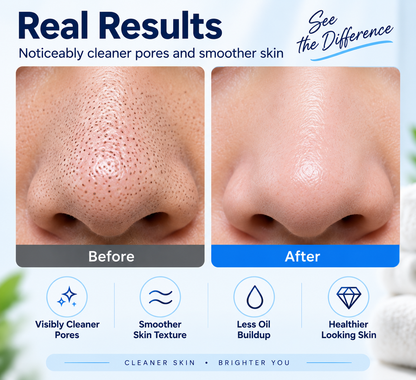 Hydro Facial Cleansing Device